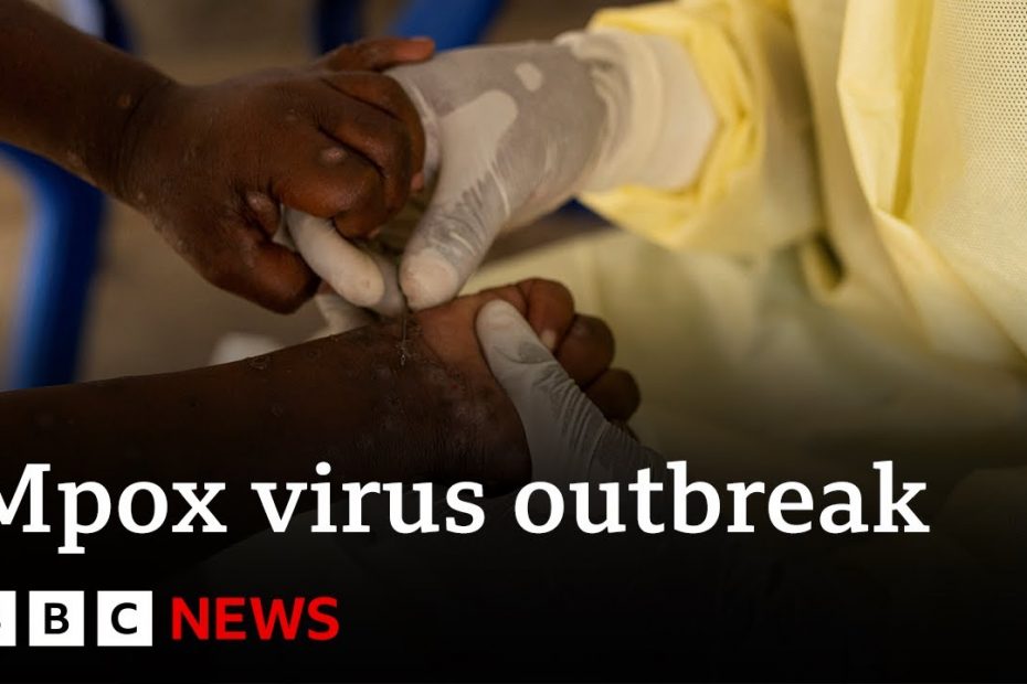 Sweden confirms first case of new mpox variant | BBC News