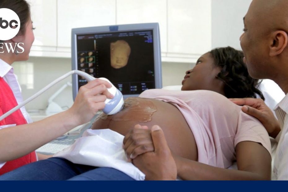 Program brings intervention, awareness and education of Black maternal health