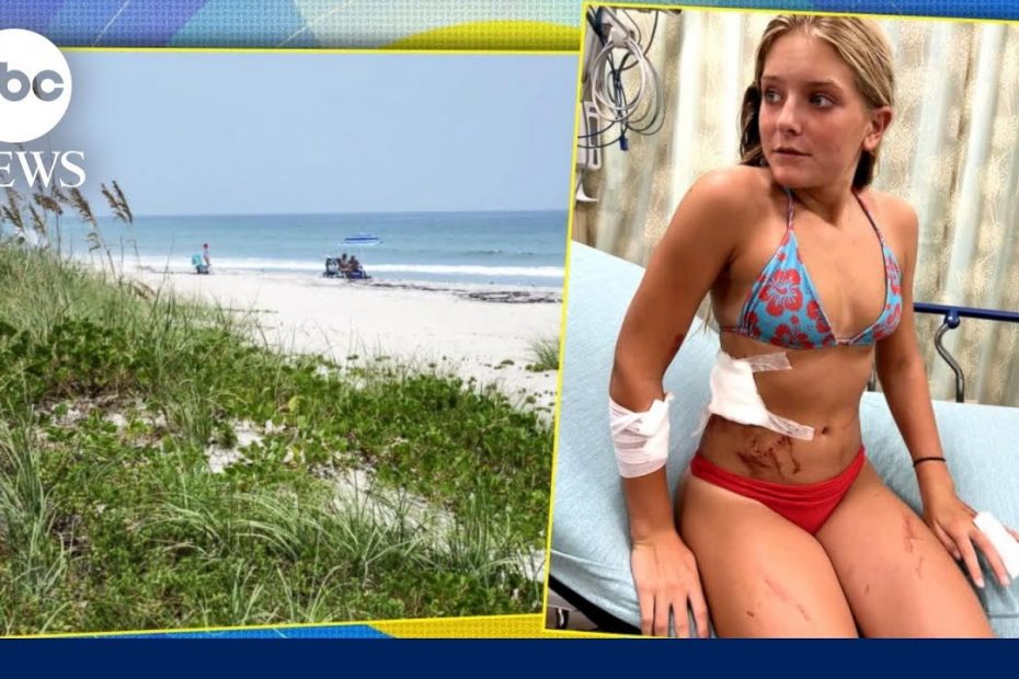 13-year-old fights off shark at beach | GMA