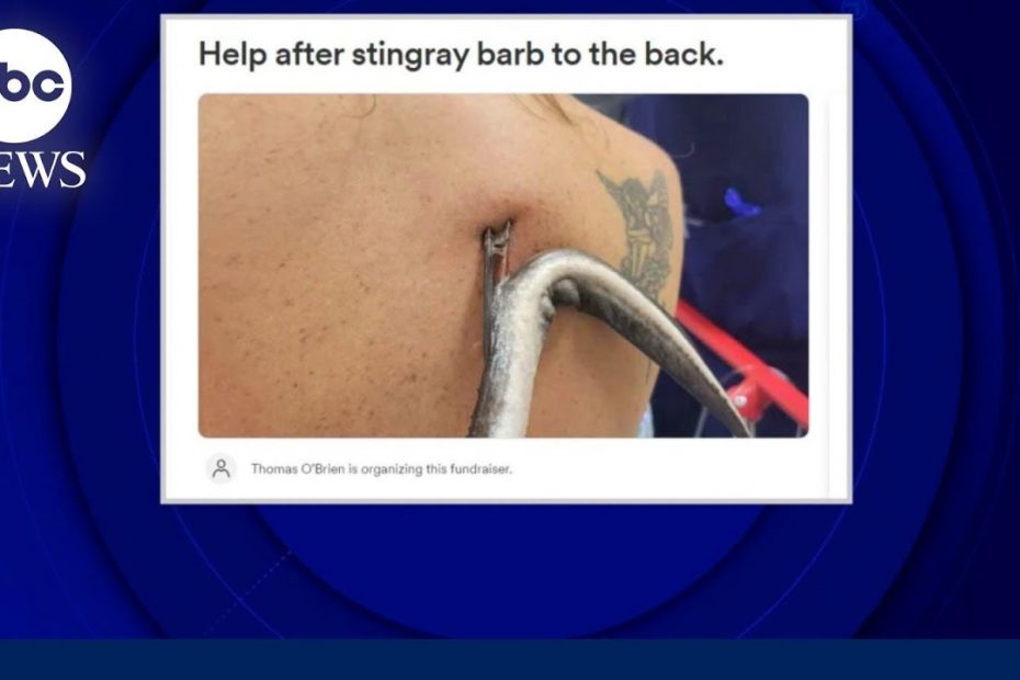 Woman speaks out after being ‘impaled’ by stingray in Florida l GMA