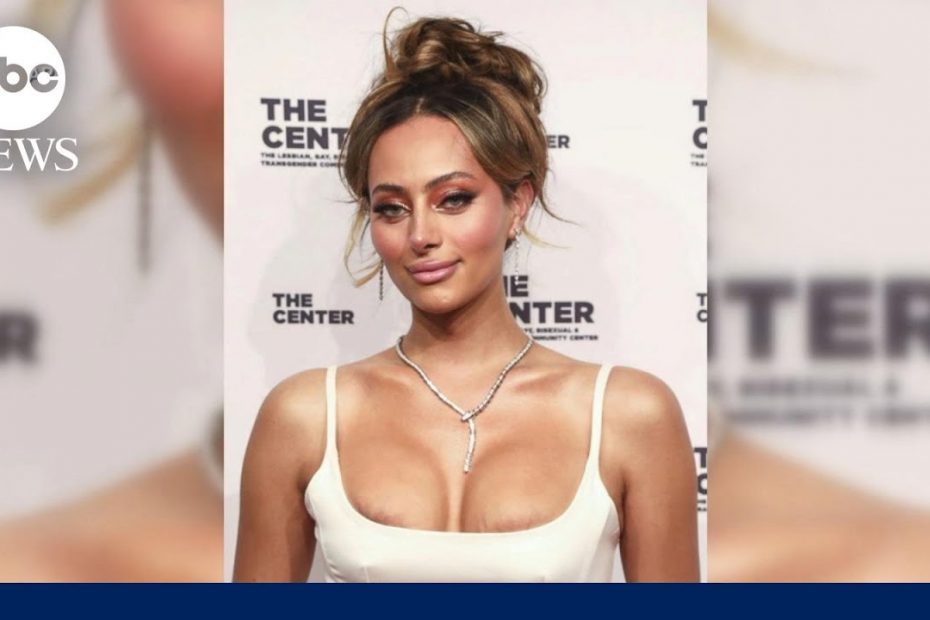 TikTalk: First Black transgender Victoria’s Secret Model on her success
