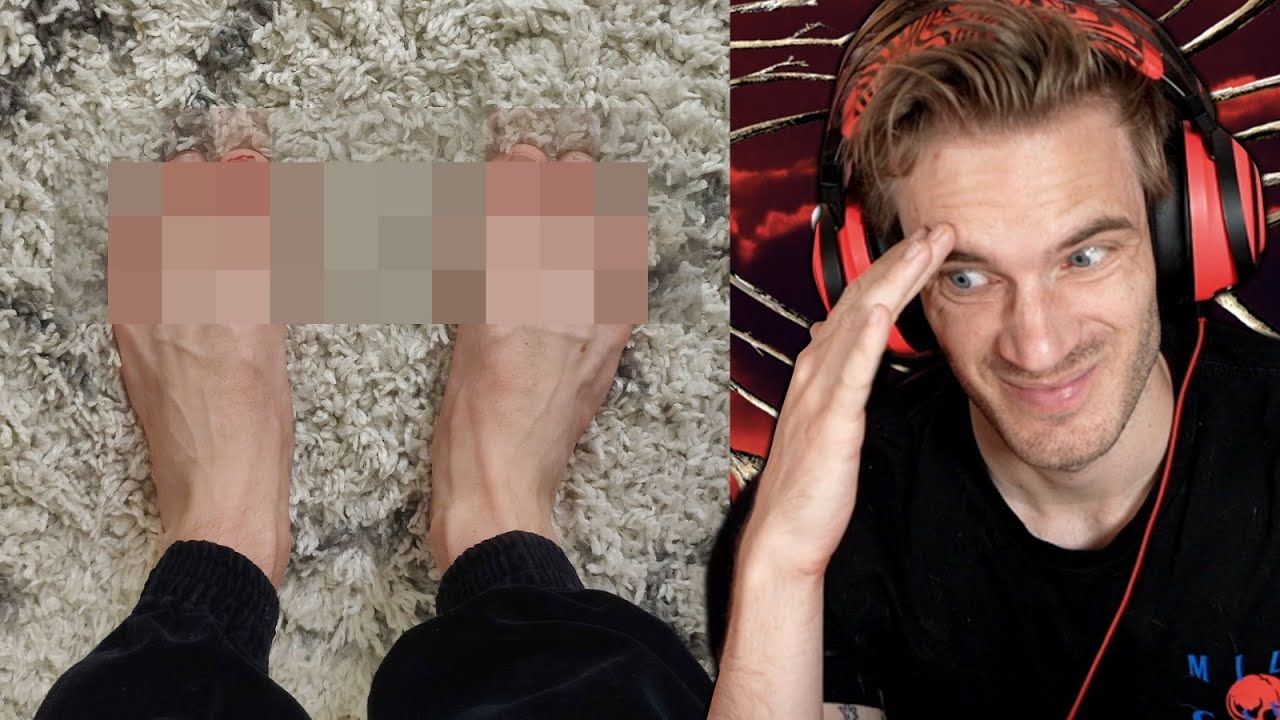 Somethings Wrong With My Feet (Feet Reveal) – LWIAY #00172