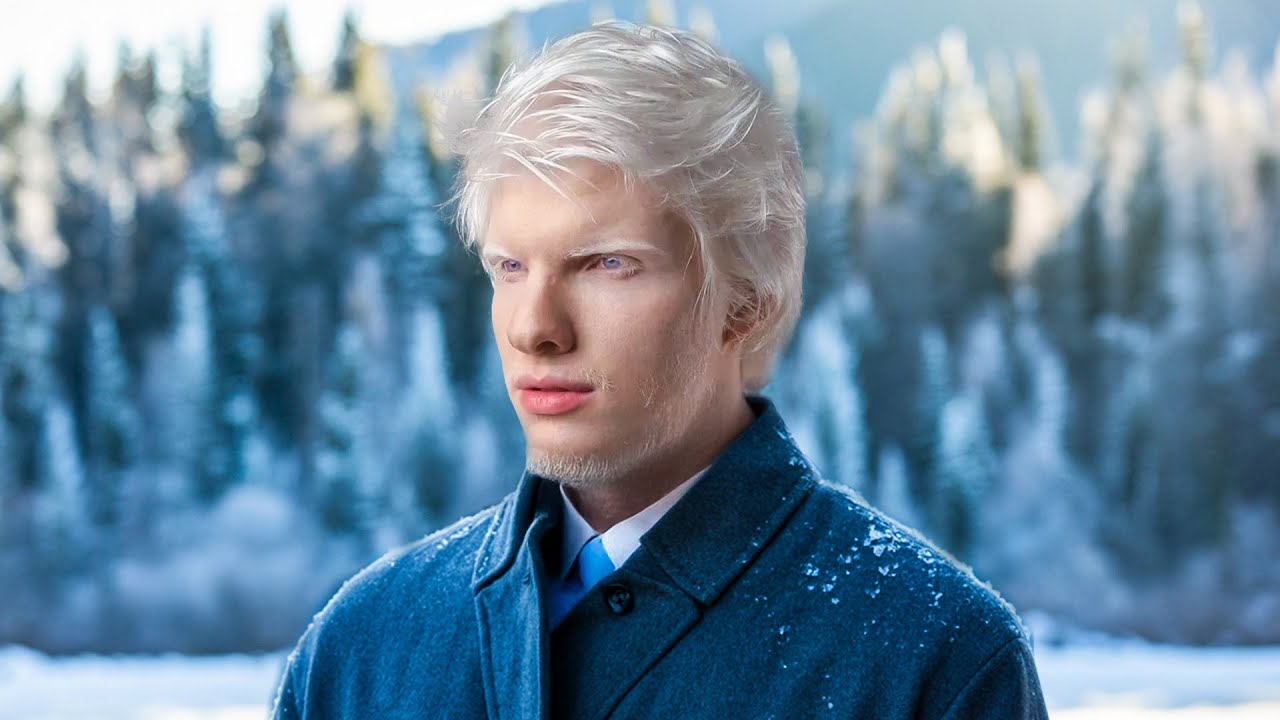 He’s The World’s Most Famous Albino