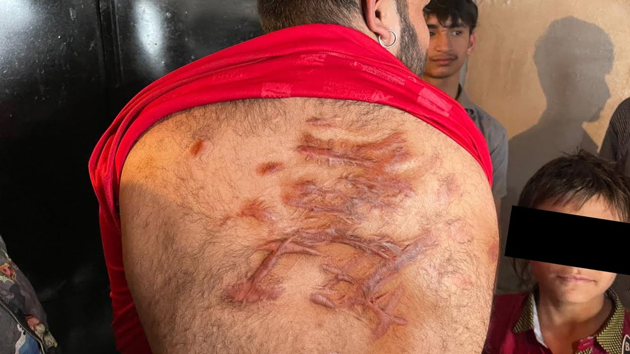 La tradición religiosa más dolorosa: Ashura | Cuchillos y golpes por el Islam